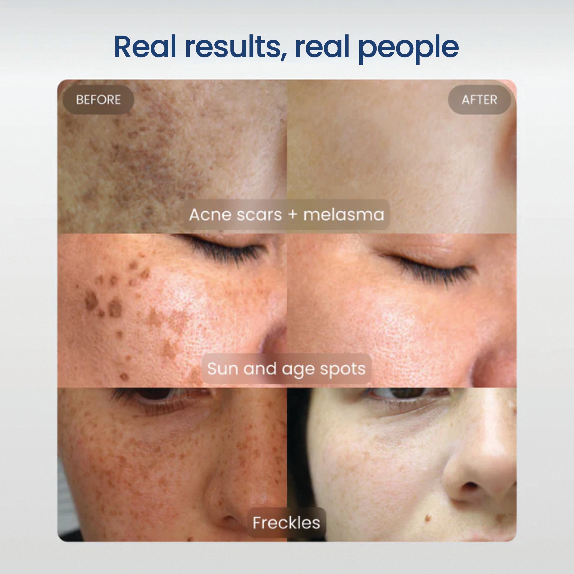 Dark Spot Corrector + Even Tone Complex