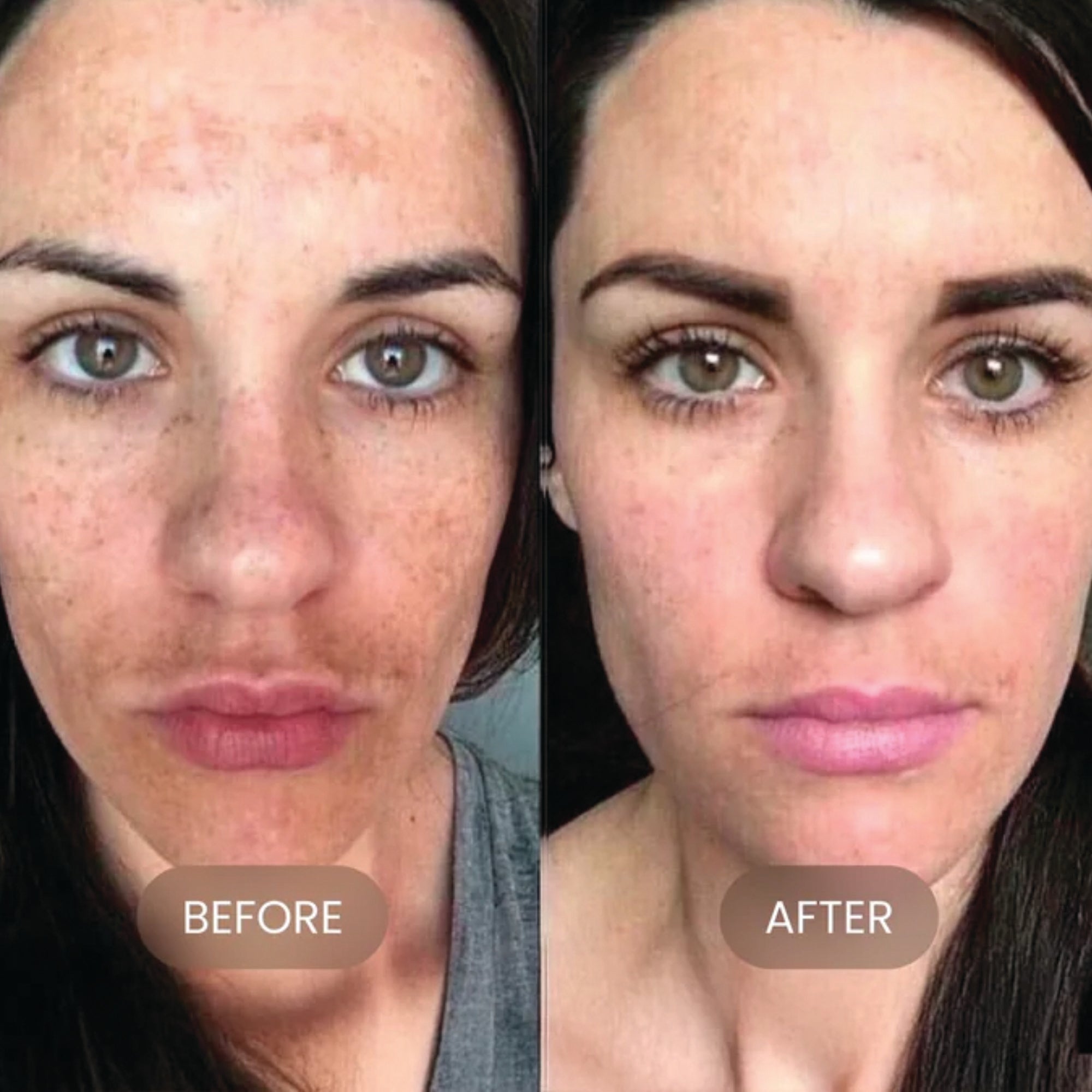 Dark Spot Corrector + Even Tone Complex
