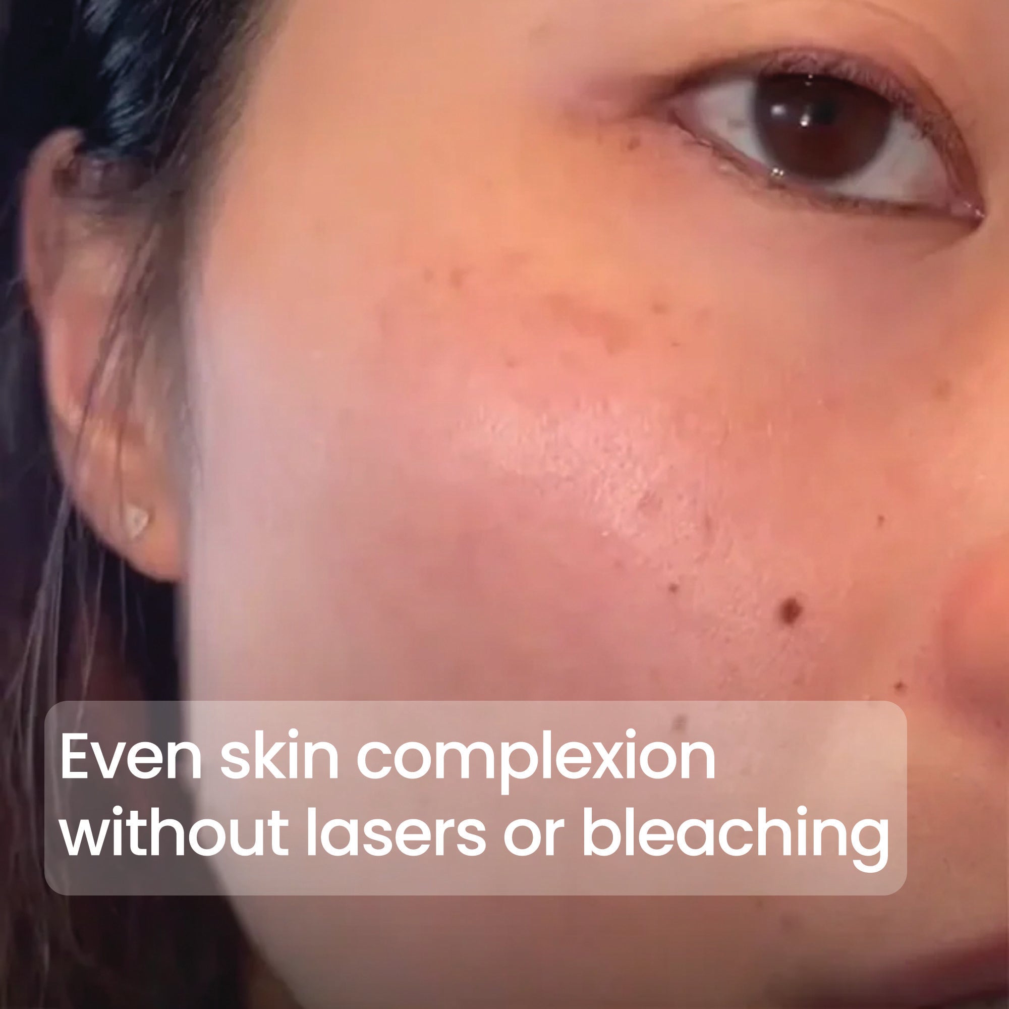 Dark Spot Corrector + Even Tone Complex