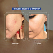 Nulifely Cyperus Rotundus Skin Serum