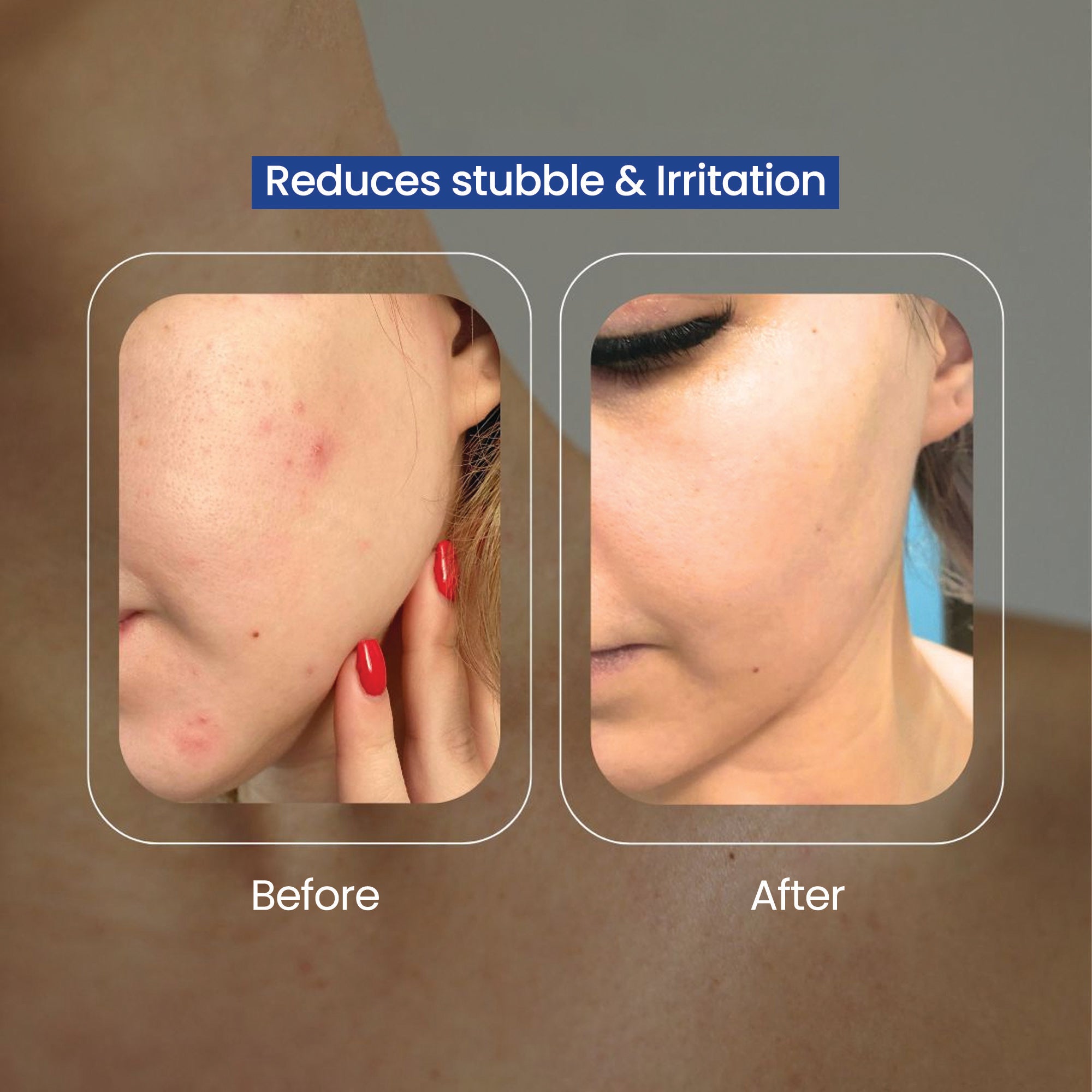 Nulifely Cyperus Rotundus Skin Serum