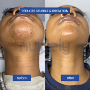 Nulifely Cyperus Rotundus Skin Serum