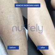 Nulifely Cyperus Rotundus Skin Serum