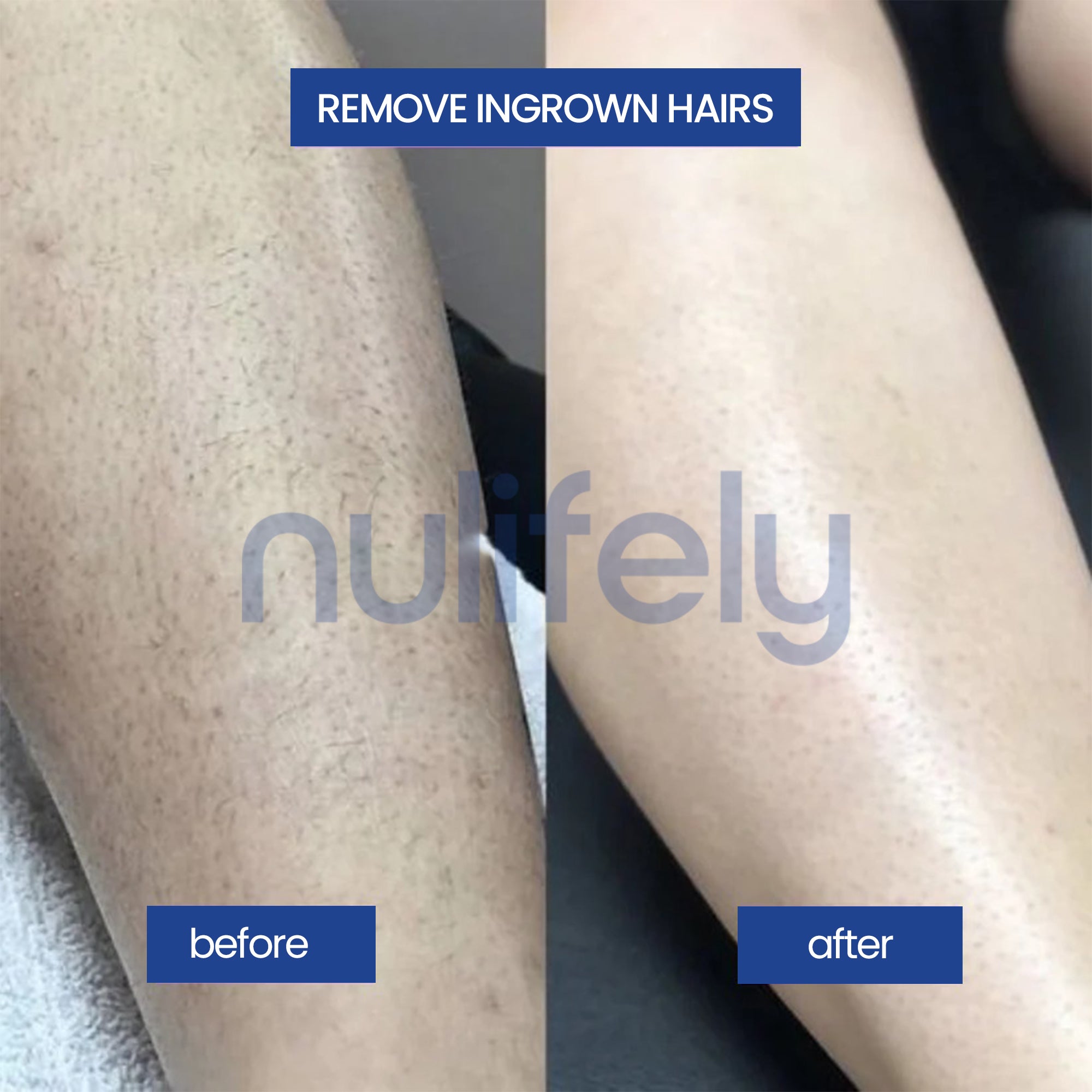 Nulifely Cyperus Rotundus Skin Serum