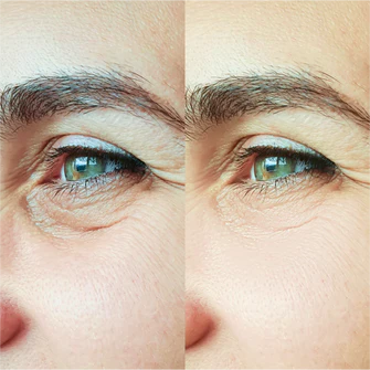 Before After