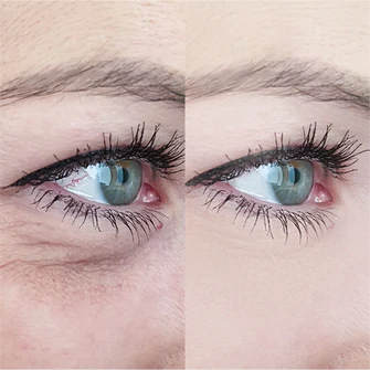 Before After