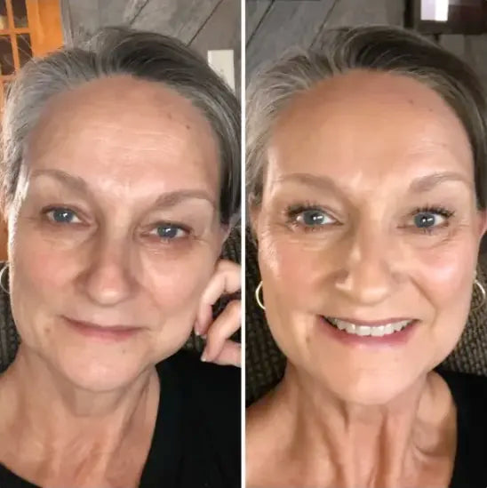Before After